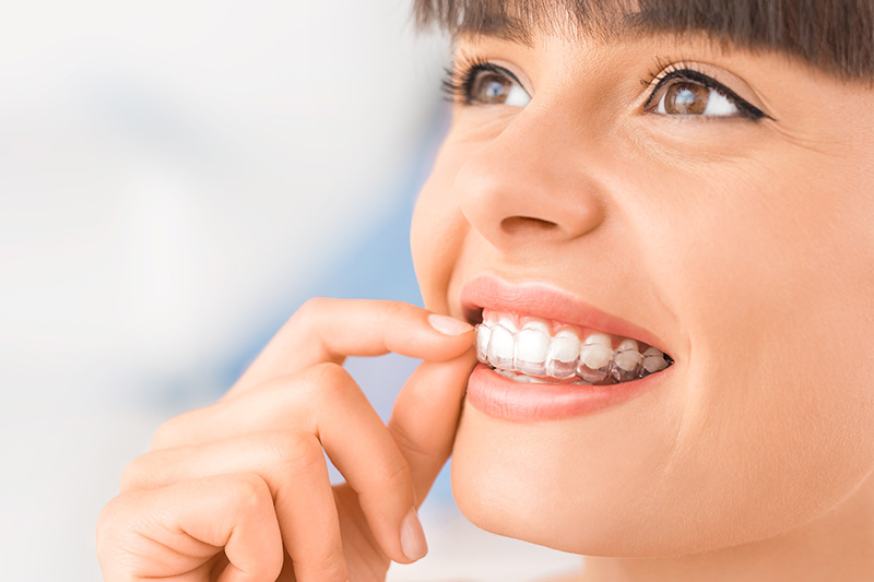 Invisalign in Kingsburg