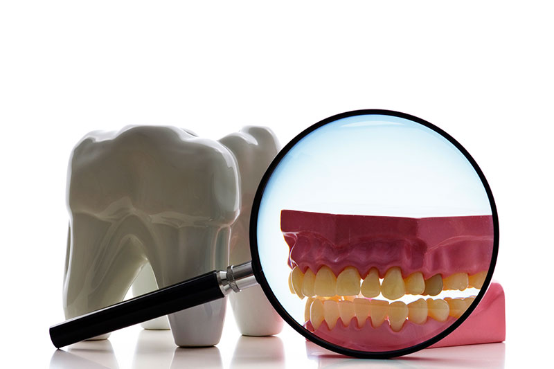 Root Canal in Kingsburg