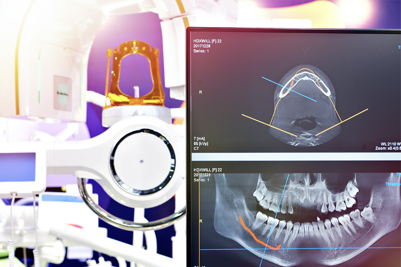 Digital X-Rays in Kingsburg